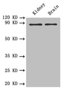 Polyclonal Rabbit anti-Human PTPRE / PTP Epsilon Antibody (IHC, WB)