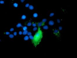 TRAP1 / HSP75 Antibody (clone OTI1A1)