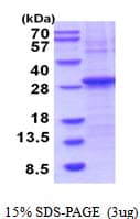 Human GZMH / Granzyme H Protein (Recombinant His)