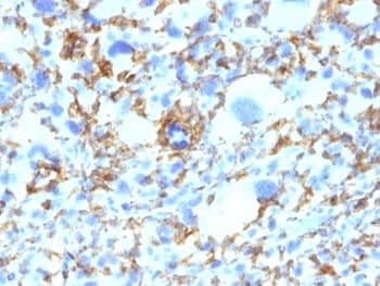 HLA-DRB1 Antibody (clone SPM423)