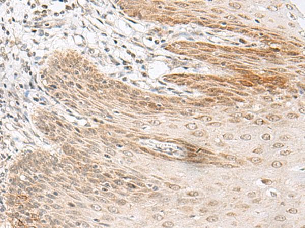 GARNL1 / RALGAPA1 Antibody