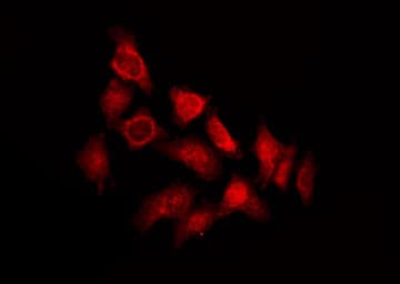 TSSK4 / TSSK5 Antibody