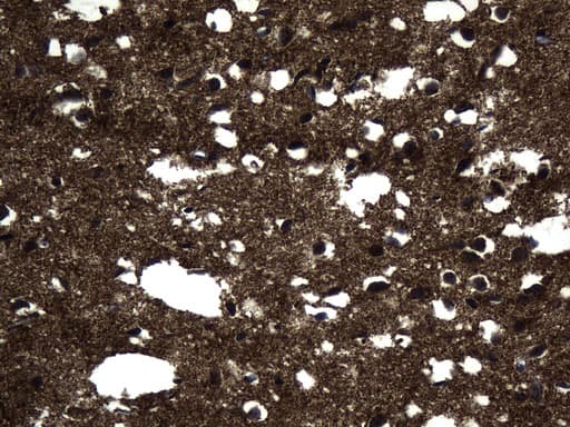 MAPT / Tau Antibody (aa623-758, clone UMAB239, Carrier-free)
