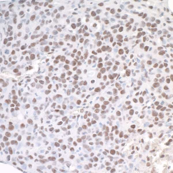 ASH2L / ASH2 Antibody (aa225-275)