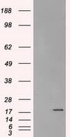 CRYAB / Alpha B Crystallin Antibody (clone OTI5C9)