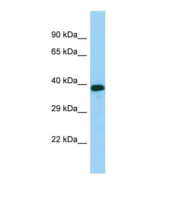 RGP1 Antibody (aa153-202)