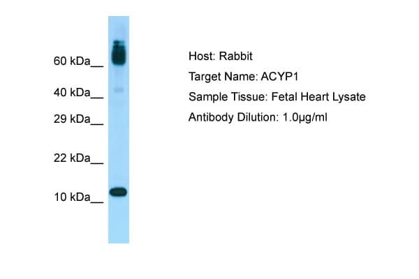 ACYP1 Antibody (aa36-85)