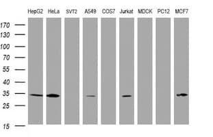 SRPRB Antibody (clone OTI3E6)