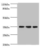 Polyclonal Rabbit anti-Human AIMP2 Antibody (aa141-320, IHC, WB)