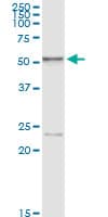 HEXA Antibody (clone 3D1)