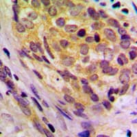 Polyclonal Rabbit anti-Human CD2BP2 Antibody (Internal, IHC, WB)