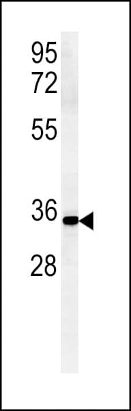 Polyclonal Rabbit anti-Human ZDHHC2 Antibody (aa77-106, IHC, WB)