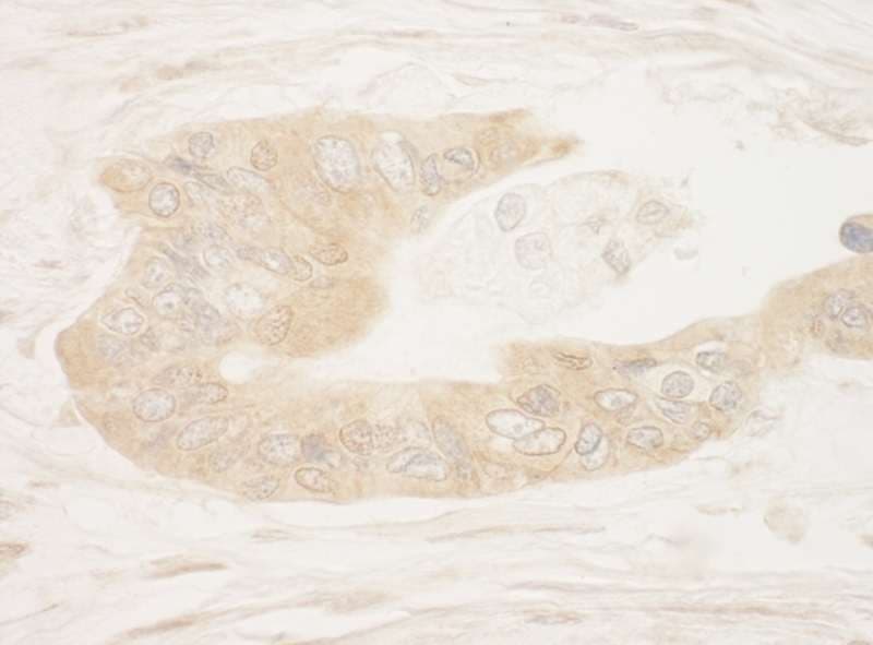 RPS6KA1 / RSK1 Antibody (aa375-425)