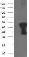 TMOD1 / Tropomodulin 1 Antibody (clone OTI1F2)