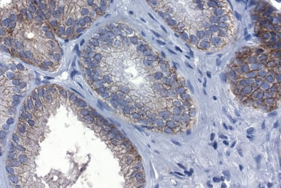CDH1 / E Cadherin Antibody (clone UMAB184)