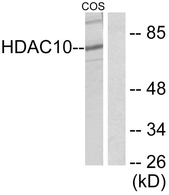 Polyclonal Rabbit anti-Human HDAC10 Antibody (aa10-59, IHC, WB)