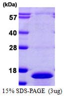 Human CDC26 Protein (Recombinant His)