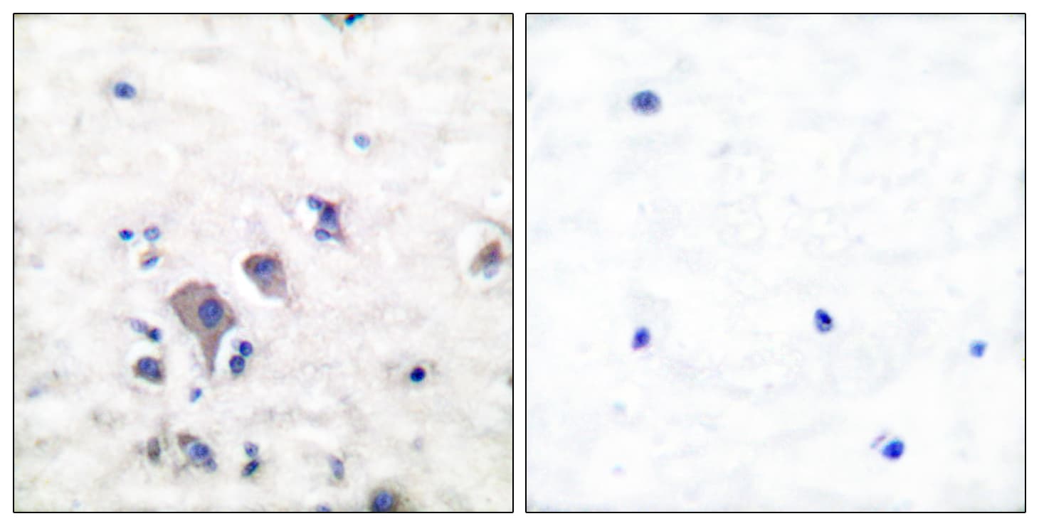 Polyclonal Rabbit anti-Human GLUR2 + GLUR3 Antibody (aa823-872, IHC, WB)