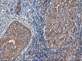 TUBAL3 Antibody (clone OTI4C5)