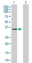 IHC-plus™ Requiem / DPF2 Antibody (clone 2F6)