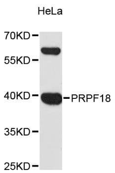 PRPF18 Antibody