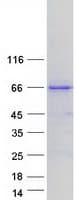 Human CLCC1 Protein (Recombinant Myc-DDK (Flag))