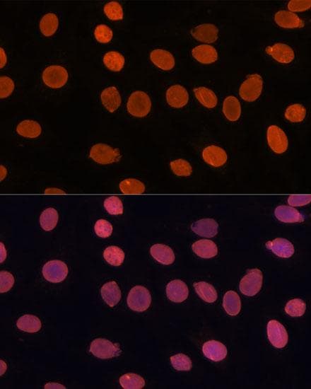 TADA3 / ADA3 Antibody