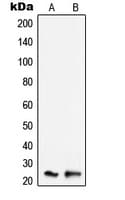 TNFAIP8 / SCC-S2 Antibody (Internal)