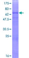 Human FUT9 Protein (Recombinant GST)