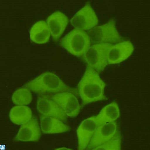 FASN / Fatty Acid Synthase Antibody