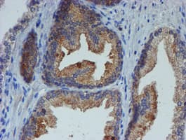 ER Alpha / Estrogen Receptor Antibody (clone OTI1B1)
