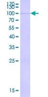 Human FBXW7 / FBW7 Protein (Recombinant GST)