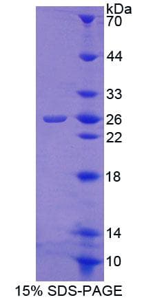 Human Calneuron-1 / CALN1 Protein (Recombinant His-T7)