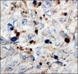 WT1 / Wilms Tumor 1 Antibody (aa1-181, clone 6F-H2)