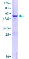 Human C20orf11 / TWA1 Protein (Recombinant GST)