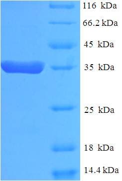 Human EEF1E1 / AIMP3 Protein (Recombinant His-SUMO)