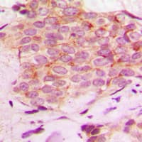 IHC-plus™ Polyclonal Rabbit anti-Human SCGB2A2 / Mammaglobin A Antibody (Internal, IHC, IF, WB)