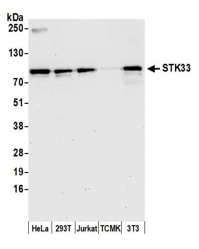 STK33 Antibody (aa464-514)