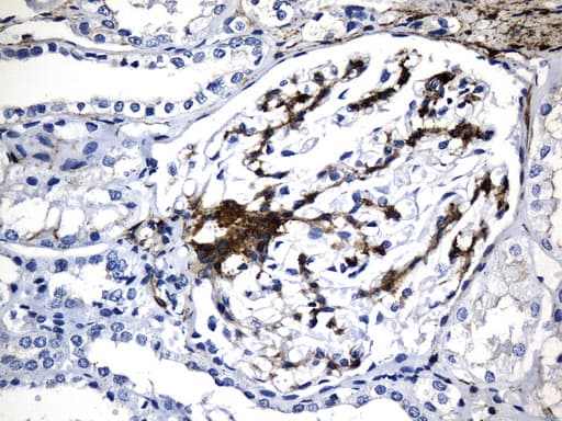 ACTA2 / Smooth Muscle Actin Antibody (N-Terminus, clone UMAB237)
