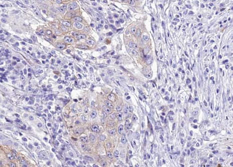 WNK1 Antibody (phospho-Thr58)