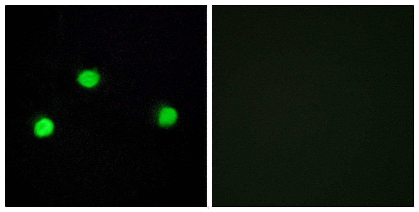 IP6K2 Antibody