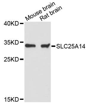 SLC25A14 / UCP5 Antibody
