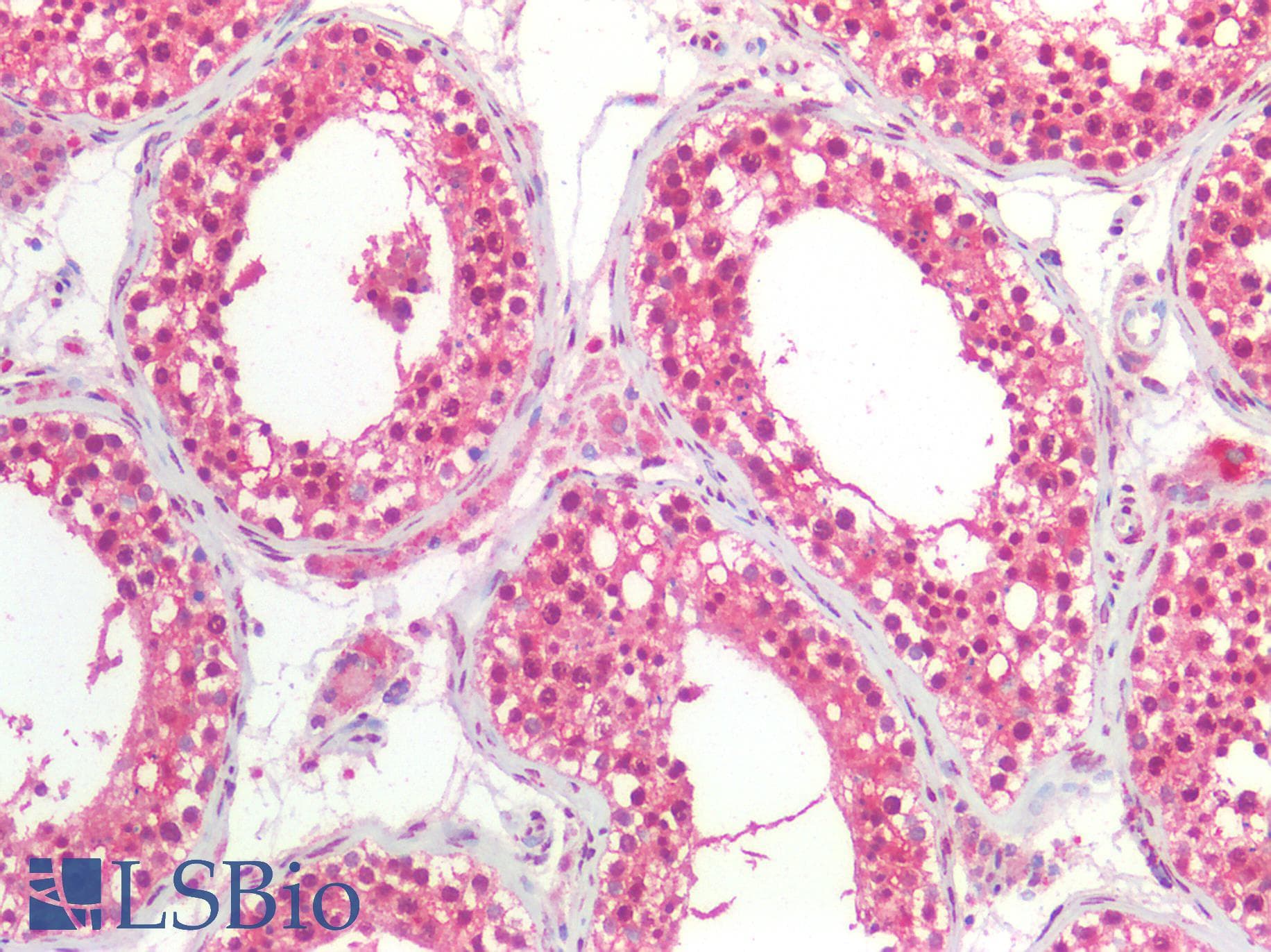 IHC-plus™ Monoclonal Mouse anti-Human SGTA / SGT Antibody (clone AT19E8, IHC, IF, WB)