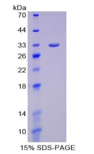 Rat SMAD6 Protein (Recombinant His-T7)