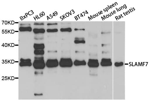 IHC-plus™ SLAMF7 / CRACC Antibody