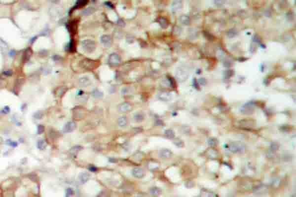IGF1R / IGF1 Receptor Antibody (Gly1155)