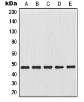 NFKBIB / IKB Beta / IKBB Antibody (N-Terminus)