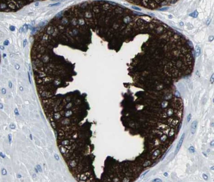 MTOR Antibody (phospho-Ser2448)