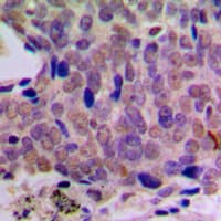 CREB1 / CREB Antibody (Internal)