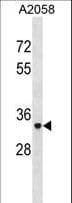IHC-plus™ ACP5 / TRAP Antibody (aa75-101)